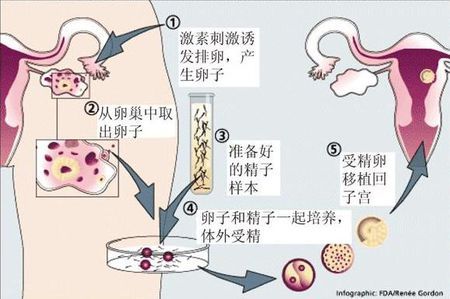 Fig.02